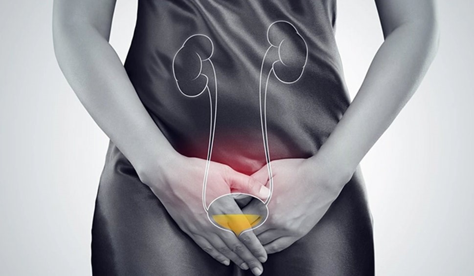 دستان زن روی قسمت تناسلی برای نشان دادن درد بر اثر عفونت ادراری